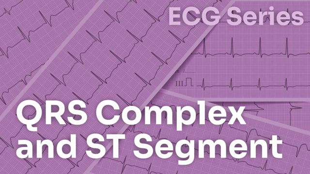 Cover image for: ECG Series: QRS Complex and ST Segment