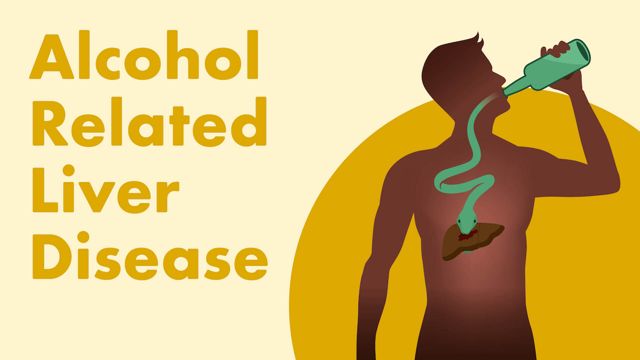 Cover image for: Alcohol-Related Liver Disease